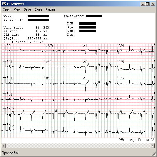 ECG Viewer provided by the C# ECG Toolkit