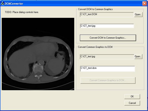 Converting a DICOM Image to a Common Graphic Format and Vice Versa ...