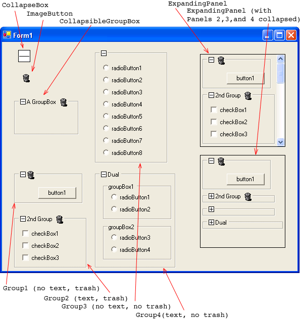 Singulair Copay Program