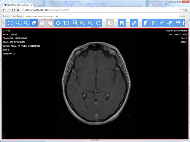 HTML5 Zero Footprint Viewer for DICOM and PACS - CodeProject
