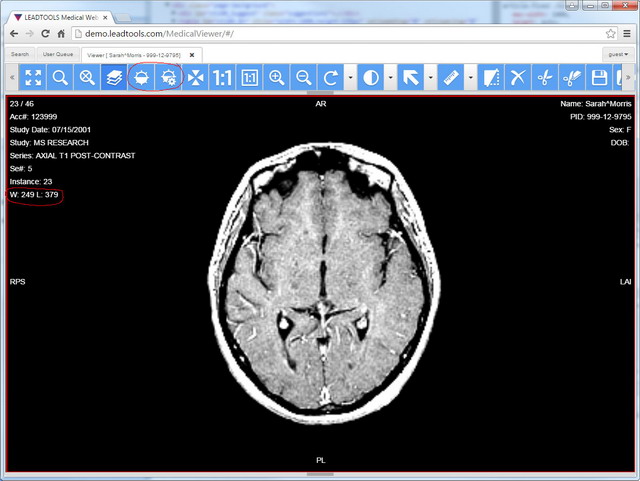 dicom open source viewer