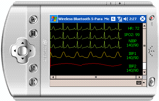 Ecg Sample