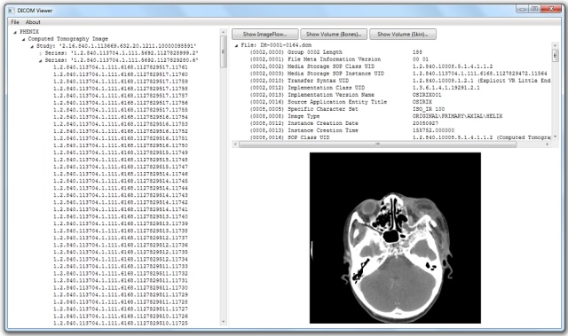 2D representation of a single CT DICOM file