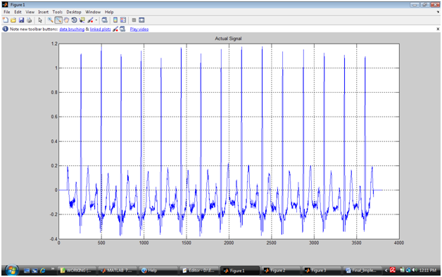 ECG-Features-Wavelet-ST/fig-1-original_ECG.png